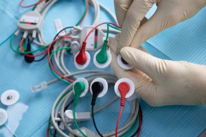 Stimulation of the vagus nerve